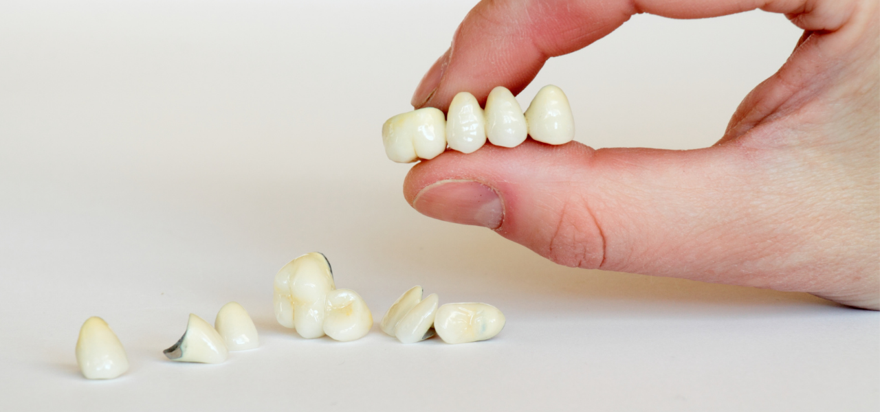 Dental Crowns in albania