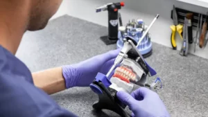 Dental Prosthesis in Albania